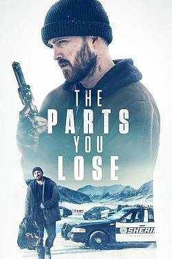 The Parts You Lose