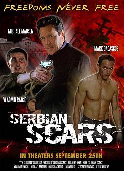 Serbian Scars